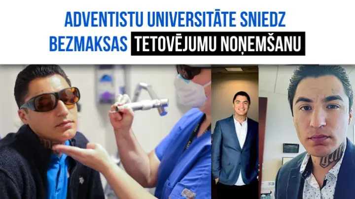 Loma Lindas universitāte izveidojusi tetovējumu noņemšanas programmu